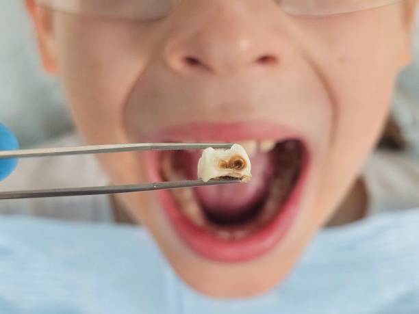 Best Knocked-Out Tooth Emergency  in College Park, GA