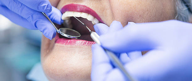 Best Knocked-Out Tooth Emergency  in College Park, GA